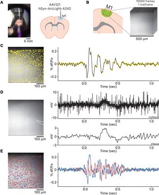 Visualizing Oscillations in Brain Slices With Genetically Encoded Voltage Indicators